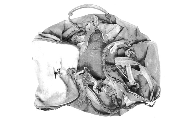 Bag containing Baby Doe's clothes