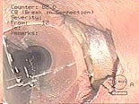 Photo of Deteriorated Sewer Line Photo of Deteriorated Sewer Line