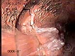 Photo of Deteriorated Sewer Line Photo of Deteriorated Sewer Line