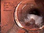Photo of Deteriorated Sewer Line Photo of Deteriorated Sewer Line