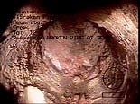 Photo of Deteriorated Sewer Line Photo of Deteriorated Sewer Line