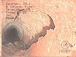 Photo of Deteriorated Sewer Line Photo of Deteriorated Sewer Line