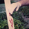 Photo of Swabbing a Bloodstain