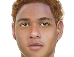 Facial Reconstruction of John Doe